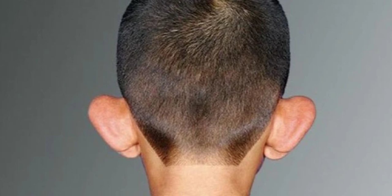 Profesörden çocuklarda kepçekulak sorunu için uyarı