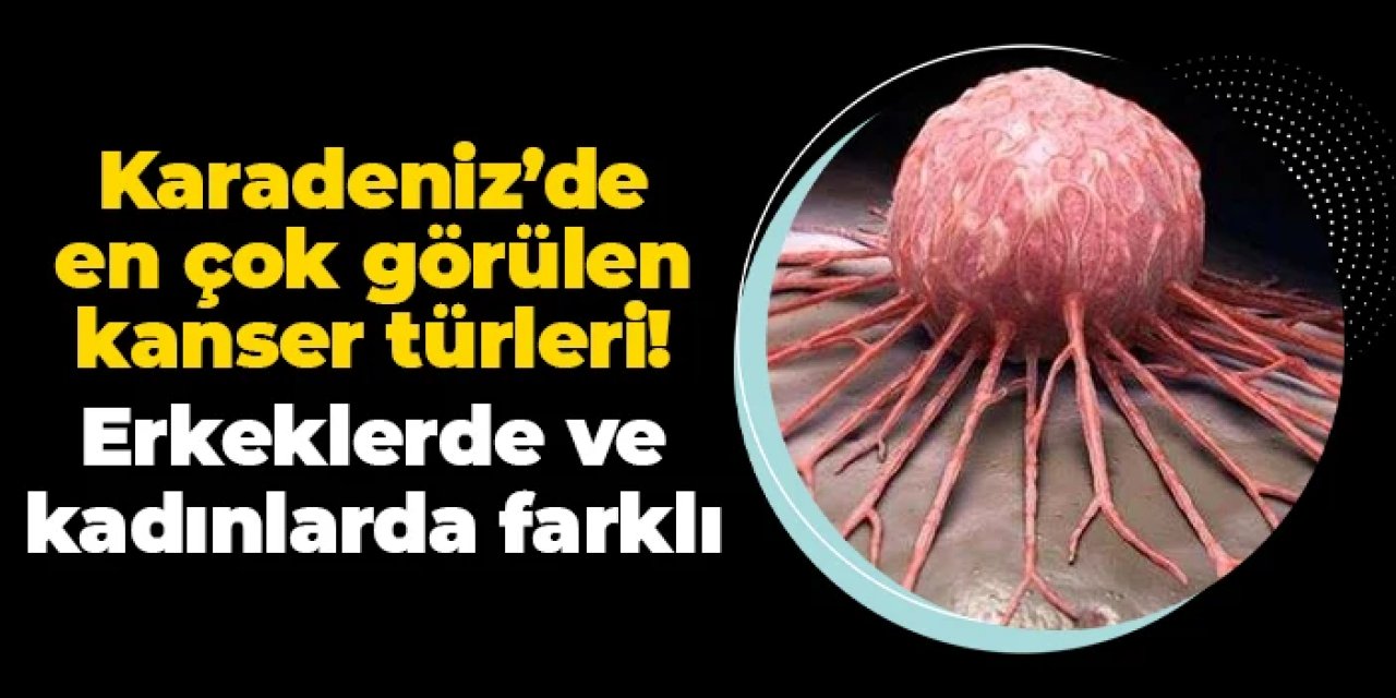 Doğu Karadeniz'de en çok görülen kanser türleri! Erkeklerde ve kadınlarda farklı...